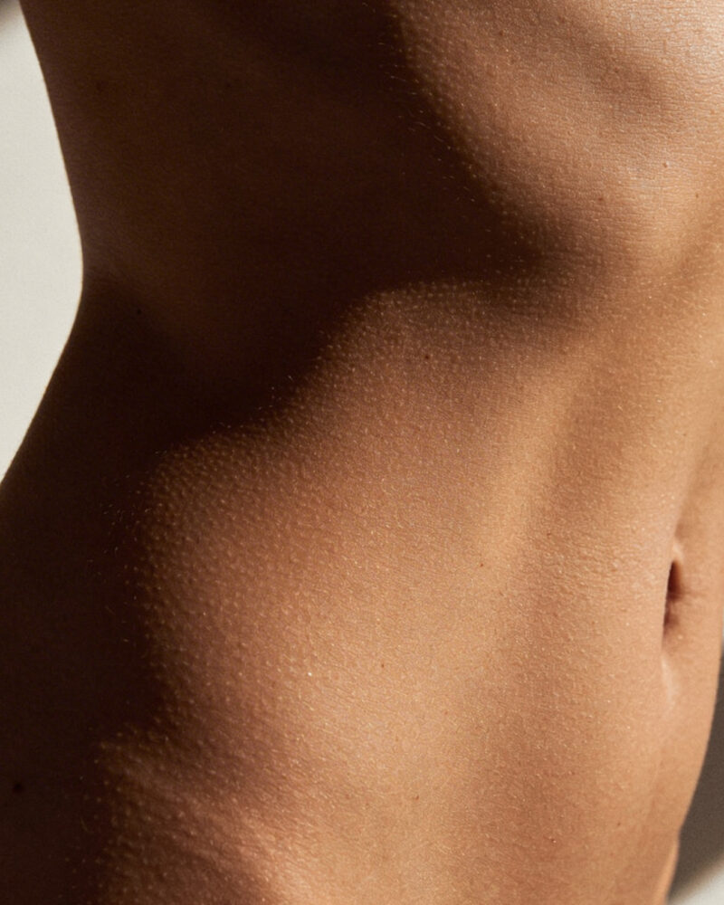 Weight Management